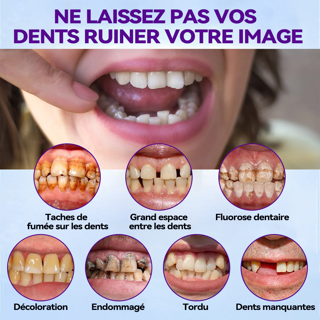 Schneider - Ensemble de Dentiers en Silicone