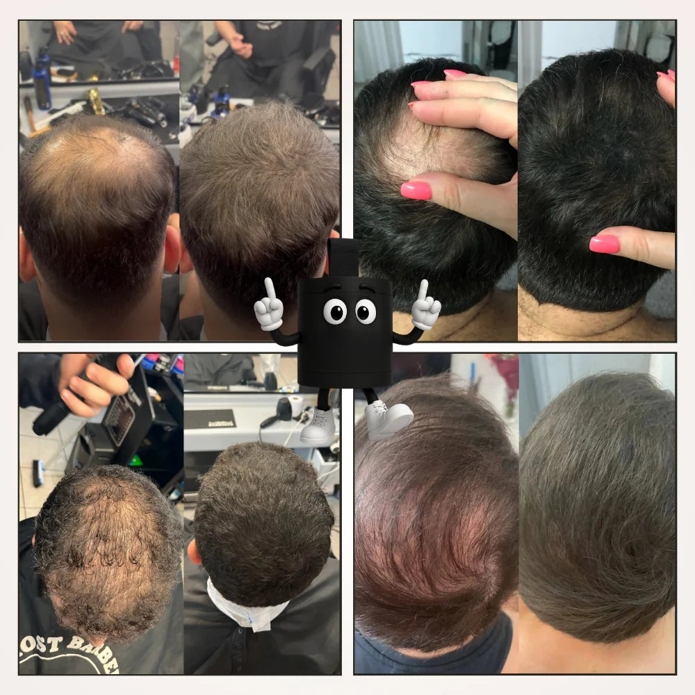 Camouflage capillaire